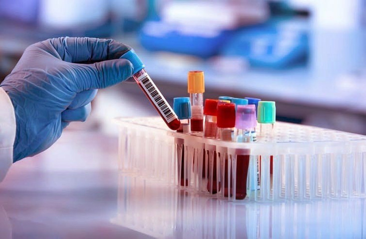 Most rare blood type in human