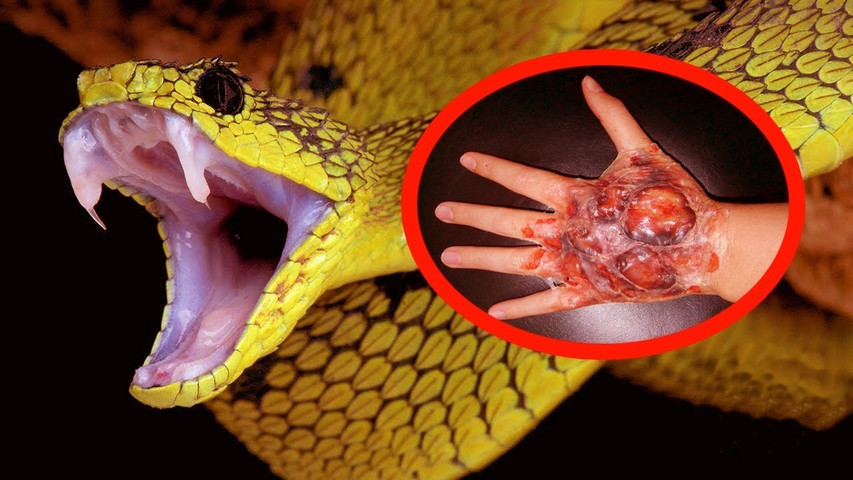 Deadliest snakes in the world