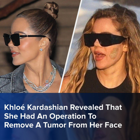 khloe kardashian had a face surgery!!