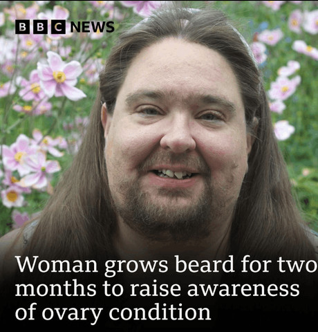 Woman with beard!!!!!!!!!