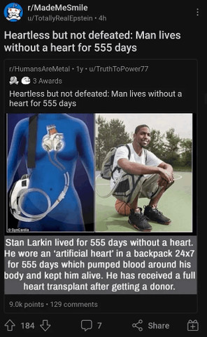 Guy survived 555 days without an actual heart.