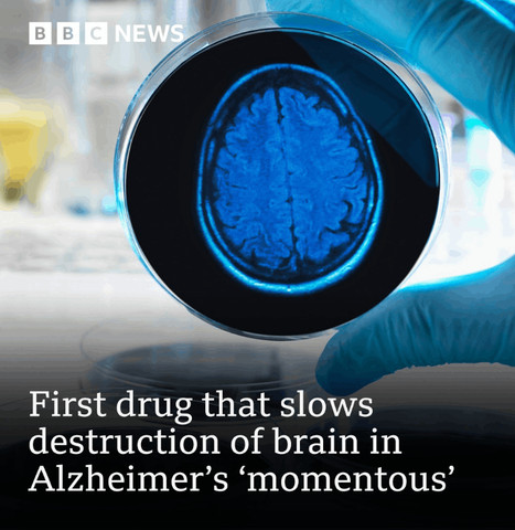 How to slow destruction of brain in Alzheimer’s????