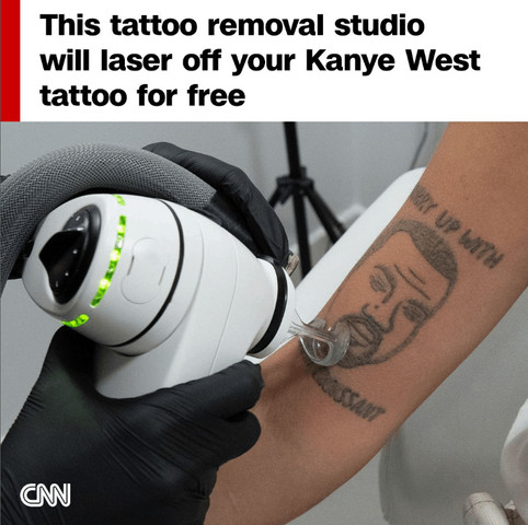 Get your tattoo removed for free