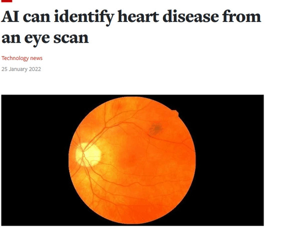 AI can identify heart disease by an eye scan