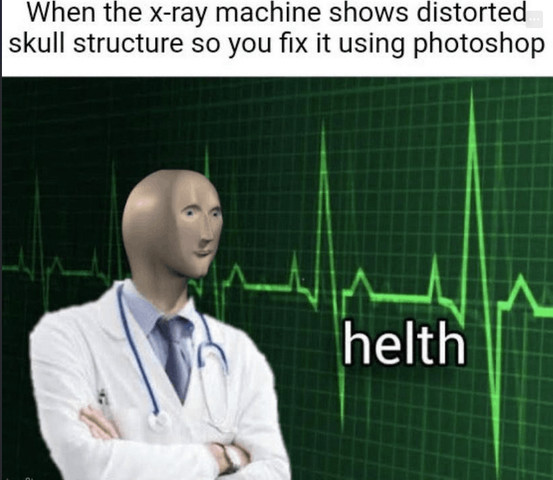 This is how I have to recover my iron level
