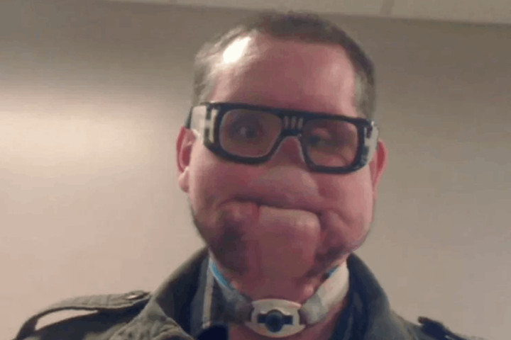 Top 10 ugliest people in the world 4- Joshua Glen Box