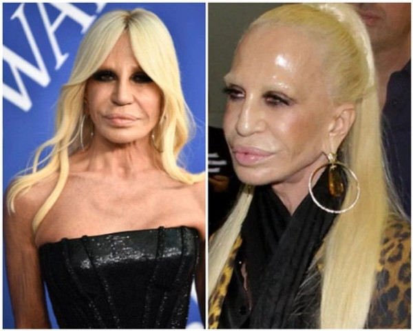 Top 10 ugliest people in the world 6- Donatlla versace
