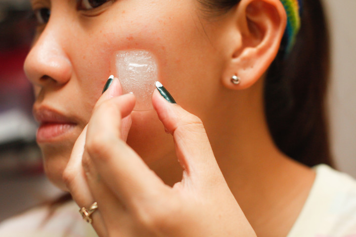 Benefits of using ice on face- Prevent Acne