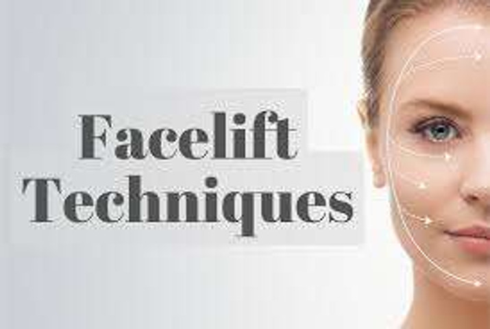 Face lift technique