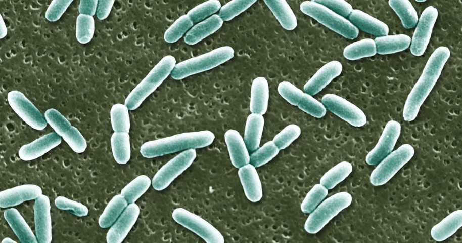 The deadly E. coli strain linked to McDonald