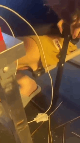 Ouch my skin