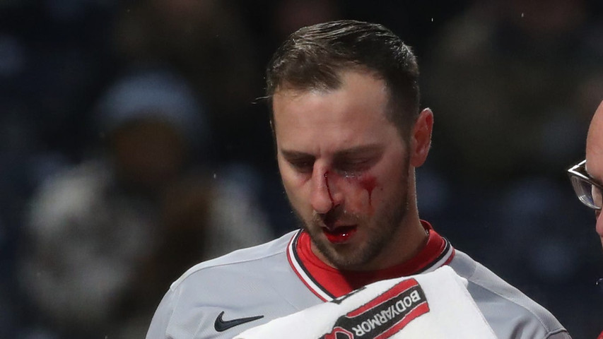 Exclusive: Drilled in face with fastball, Paul DeJong starts road back after scary moment
