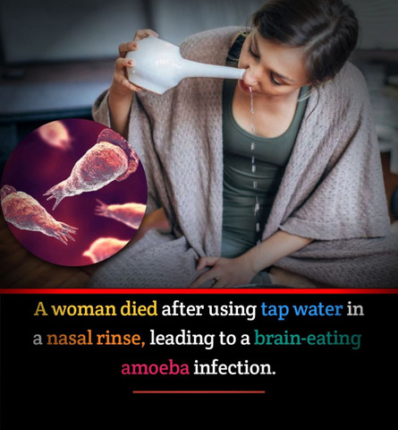 A woman died after using tap water in a nasal rinse leading to a brain eating amoeba infection