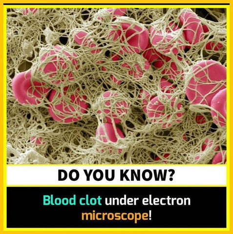 Blood clot under electron microscope!