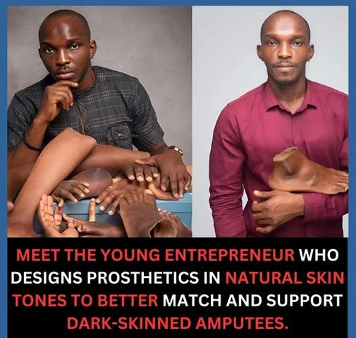 Meet the young entrepreneur who designs prosthetics in natural skin tones