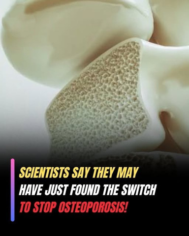 Scientists say they may have just found the switch to stop osteoporosis
