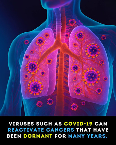 Viruses such as COVID-19 can reactivate cancers that have been dormant for many years