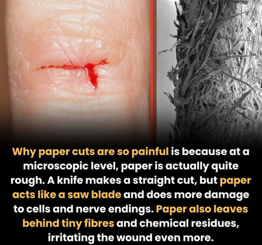 Why paper cuts are so painful is because at a microscopic level