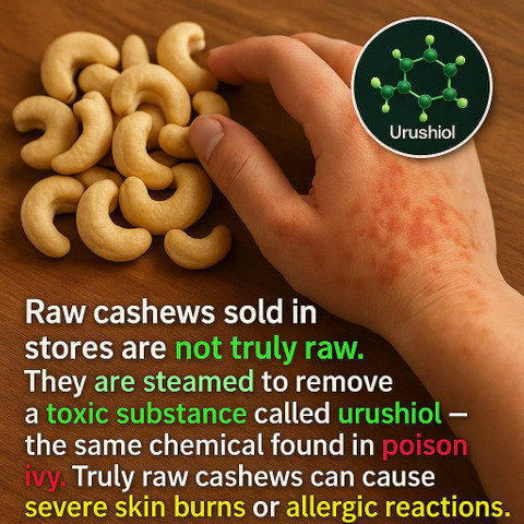 Raw cashews sold in stores are not truly raw